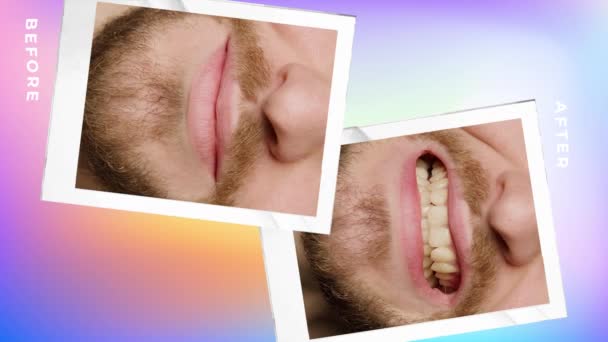 Collage Photos Superimposed Color Background White Writing Story Mans Teeth — Vídeo de Stock