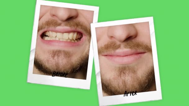 Collage Two Side Pictures Green Background Black Writing Mans Teeth — Wideo stockowe