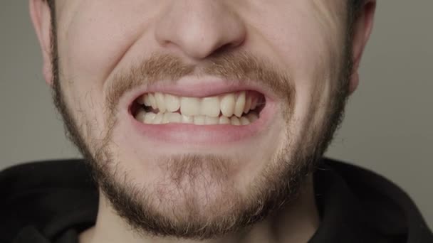 Young Man Beard Who Smiles Widely Shows All His Teeth — Stok video