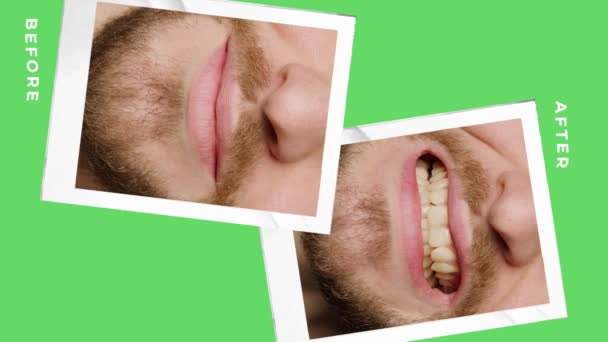 Collage Superimposed Photos Green Background White Writing Story Mans Teeth — Wideo stockowe