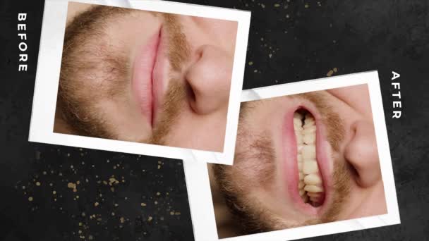 Collage Photos Superimposed Gray Background White Writing Story Mans Teeth — Wideo stockowe