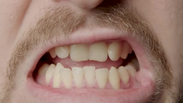 Close Mans Teeth Uneven Crooked Teeth Need Dental Treatment Bearded — Video Stock