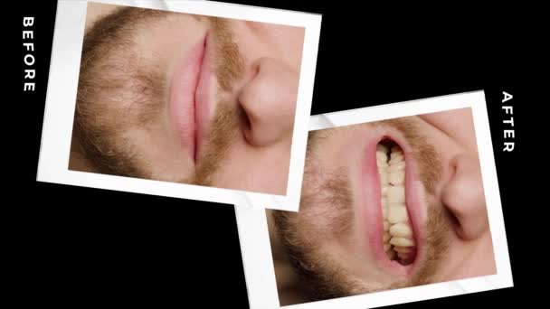 Collage Photos Superimposed Black Background White Writing Story Mans Teeth — Wideo stockowe