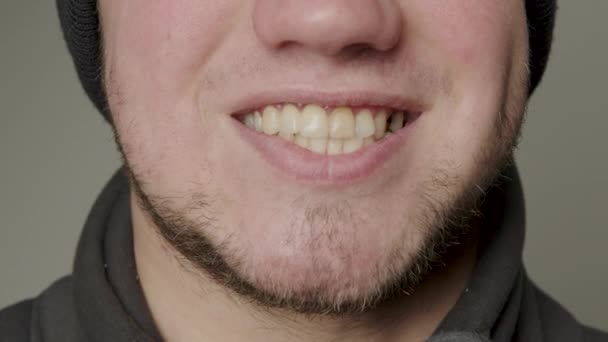 Gran Sonrisa Hombre Barbudo Dientes Torcidos Dientes Rotos Dientes Que — Vídeos de Stock