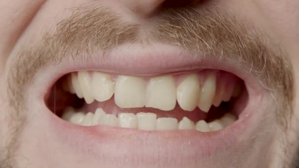 Young Man Beard Smiling Broadly Showing All His Teeth Young — Vídeo de stock