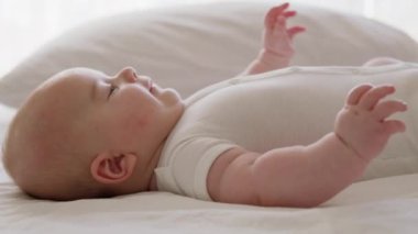 Parlak bir odada sırtüstü uzanmış beyaz elbiseli bir çocuğun yan görüntüsü. Aktif çocuk geniş bir şekilde gülümser, bacaklarını tekmeler ve ellerini ağzına koyar. Kızarıklık ve atopik deri iltihabı olan bir çocuk.