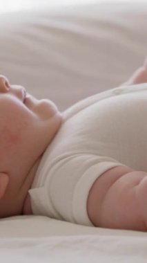 Parlak bir odada sırtüstü uzanmış beyaz elbiseli bir çocuğun yan görüntüsü. Aktif çocuk geniş bir şekilde gülümser, bacaklarını tekmeler ve ellerini ağzına koyar. Kızarıklık ve atopik deri iltihabı olan bir çocuk.