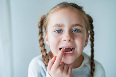 Çocuğun dişleri döküldü. Dişsiz küçük bir kızın portresi. Ev.