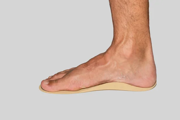Нога Ортопедической Ортопедической Стельке Поддержки Дуги Плоских Ног Белом Фоне — стоковое фото
