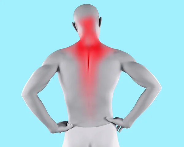 Återge Illustration Manlig Figur Med Nacke Och Ryggmuskel Smärta Markerade — Stockfoto