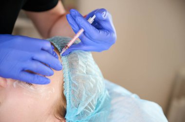 Kozmetik uzmanı hastanın yüzüne cerrahi olmayan düzeltmeler yapmak için madde enjekte ediyor. Doldurucu iğneler. Estetik düzeltici tedavi kavramı.