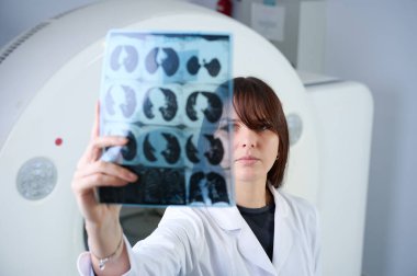 Genç bayan radyologlar tomografi odasında kalıyorlar. Klinikte çalışıyorum. Güzel doktor röntgen, röntgen, tomografi ve MRI 'ya bakıyor. Üniformalı doktor.