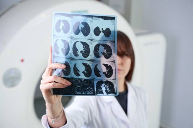 Genç bayan radyologlar tomografi odasında kalıyorlar. Klinikte çalışıyorum. Güzel doktor röntgen, röntgen, tomografi ve MRI 'ya bakıyor. Üniformalı doktor.