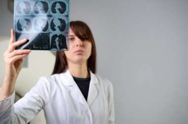 Genç bayan radyologlar tomografi odasında kalıyorlar. Klinikte çalışıyorum. Güzel doktor röntgen, röntgen, tomografi ve MRI 'ya bakıyor. Üniformalı doktor.