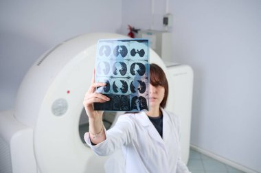 Genç bayan radyologlar tomografi odasında kalıyorlar. Klinikte çalışıyorum. Güzel doktor röntgen, röntgen, tomografi ve MRI 'ya bakıyor. Üniformalı doktor.