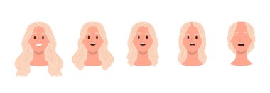 Saç dökülmesi sorunu olan androgenetik alopecia semptomları ve kelleşme aşamaları. Kılsız kadın, ön görüş vektör illüstrasyonunu geliştiriyor. Güzellik, ilaç ve sağlık konsepti