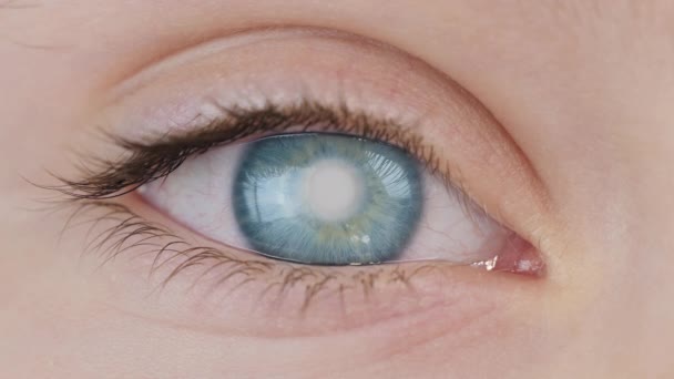 Катаракта Человеческого Глаза Дефект Прозрачности Роговицы — стоковое видео