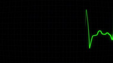 Elektrokardiyogram cihazının ekranındaki kalp atışı frekansı yakın planda. EKG veya ECG kalp atış hızı düz çizgi