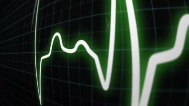 EKG nabız oranı. Kalp atışı ya da kalp ritmi yakından..