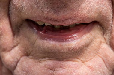 Güneşli bir günde, yaşlı bir adamın ağzına yakın çekim.