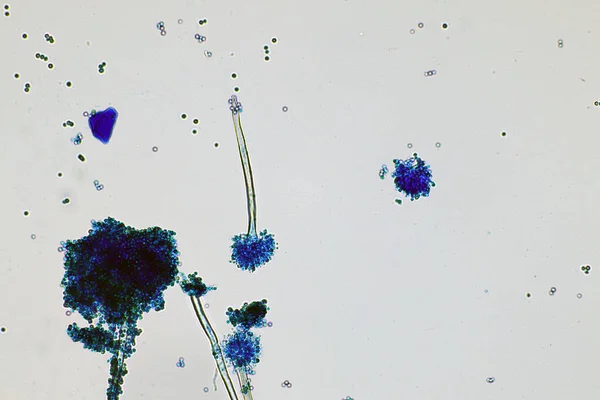 Μικροσκόπιο Του Μαύρου Στελέχους Σπόρου Μύκητα Lactophenol Βαμβακερό Μπλε Καλούπια — Φωτογραφία Αρχείου
