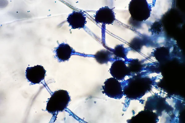 Microscópio Estirpe Esporos Fungos Pretos Com Lactofenol Algodão Azul Moldes — Fotografia de Stock