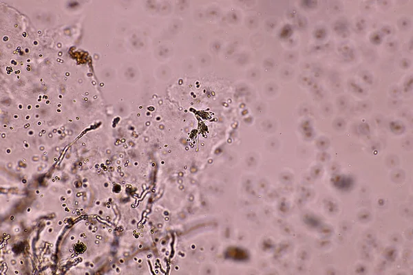 用乳胶红 宏观40X晶状体 空气室内污染 气溶胶污染环境对黑曲霉孢子株的显微观察 微生物学实验室概念 — 图库照片