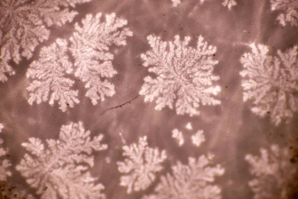 플라스틱 입자가 플라스틱 폐기물의 형태를 눈송이의 현미경은 매크로 40X 연구소가 — 스톡 사진