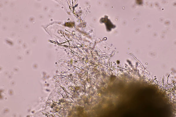 Microscópio Estirpe Esporos Fungos Pretos Com Algodão Lactofenol Vermelho Moldes — Fotografia de Stock