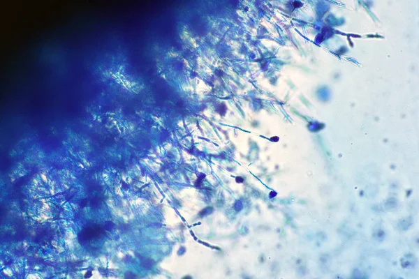 Microscopio Cepa Esporas Hongos Negros Con Algodón Lactofenol Azul Moldes — Foto de Stock