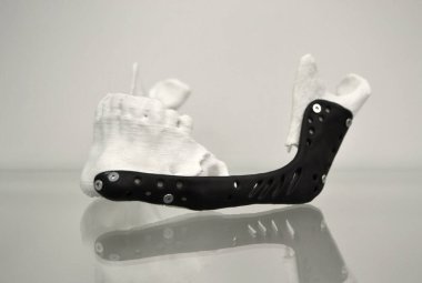 3D baskı plastik prototip insan alt çene ve tıbbi titanyum implant yakın plan. Metal tozundan basılmış siyah protez anatomik insan kemiği. Ortopedik maksimum yüz protezi