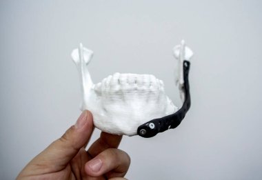 Elinde 3D baskı plastik prototip insan alt çene ve tıbbi titanyum implantı tutan kişi. Metal tozundan basılmış protez anatomik kemik 3D. Ortopedik maksimum yüz protezi