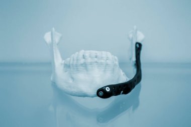 3D baskı plastik prototip insan alt çene ve tıbbi titanyum implant yakın plan. Metal tozundan basılmış siyah protez anatomik insan kemiği. Ortopedik maksimum yüz protezi