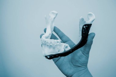 Elinde 3D baskı plastik prototip insan alt çene ve tıbbi titanyum implantı tutan kişi. Metal tozundan basılmış protez anatomik kemik 3D. Ortopedik maksimum yüz protezi