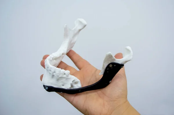Person Holding Hand Printed Plastic Prototype Human Lower Jaw Medical — Stock Photo, Image