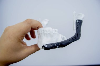 Elinde 3D baskı plastik prototip insan alt çene ve tıbbi titanyum implantı tutan kişi. Metal tozundan basılmış protez anatomik kemik 3D. Ortopedik maksimum yüz protezi