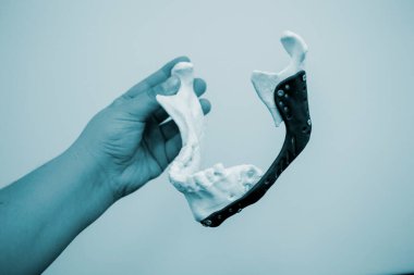 Elinde 3D baskı plastik prototip insan alt çene ve tıbbi titanyum implantı tutan kişi. Metal tozundan basılmış protez anatomik kemik 3D. Ortopedik maksimum yüz protezi