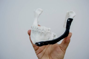 Elinde 3D baskı plastik prototip insan alt çene ve tıbbi titanyum implantı tutan kişi. Metal tozundan basılmış protez anatomik kemik 3D. Ortopedik maksimum yüz protezi