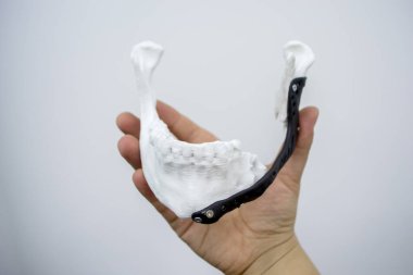 Elinde 3D baskı plastik prototip insan alt çene ve tıbbi titanyum implantı tutan kişi. Metal tozundan basılmış protez anatomik kemik 3D. Ortopedik maksimum yüz protezi