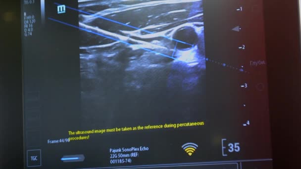 Utrasound Image Monitor Close Ultrasound Scan Display Screening Ultrasonography Analysis — Vídeo de Stock