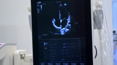 Utrasound image on the monitor close-up. Ultrasound Scan display. Screening Ultrasonography Analysis of person. Ultrasound examination Using Scanner. Ultrasound Scan Device. Echocardiography
