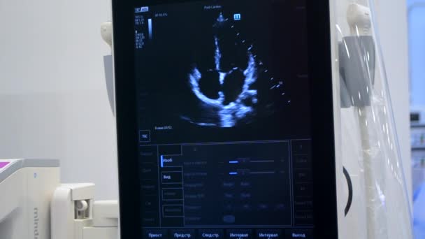Utrasound Image Monitor Close Ultrasound Scan Display Screening Ultrasonography Analysis — Stock video