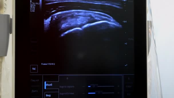 Utrasound Image Monitor Close Ultrasound Scan Display Screening Ultrasonography Analysis — Stockvideo