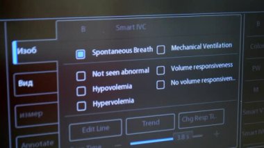 Utrasound image on the monitor close-up. Ultrasound Scan display. Ultrasound Scan Device. Echocardiography. Screening Ultrasonography Analysis of person. Ultrasound examination. Using Scanner.