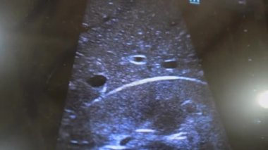 Utrasound image on the monitor close-up. Ultrasound Scan display. Echocardiography. Screening Ultrasonography Analysis of person. Ultrasound examination Using Scanner. . Ultrasound Scan Device.