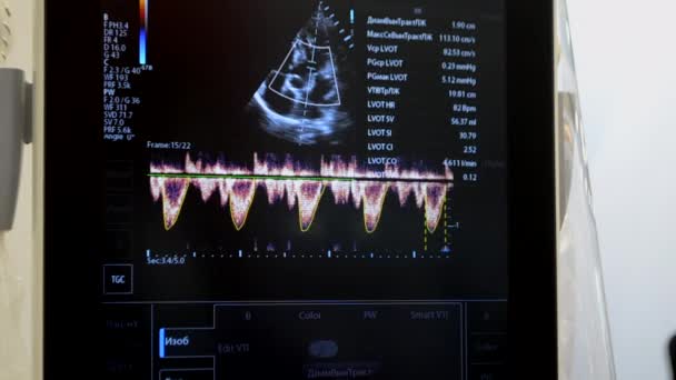 Obraz Usg Zbliżeniu Monitora Wyświetlacz Usg Urządzenie Prześwietlania Ultradźwiękowego Echokardiografia — Wideo stockowe