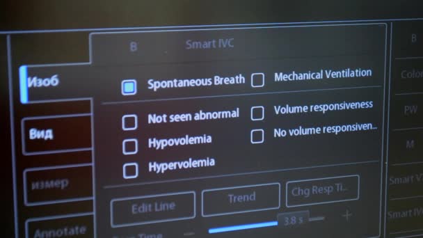 Echografie Monitor Close Ultrasone Scan Weergave Echografie Scan Apparaat Echocardiografie — Stockvideo