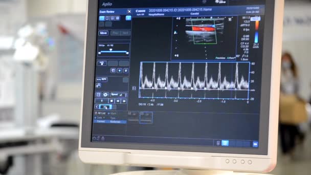 Utrazvuk Monitoru Zblízka Ultrazvukové Skenování Používám Skener Screening Ultrasonografie Analýza — Stock video