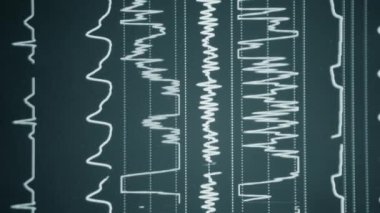 Modern hasta gözlemcisi. Elektronik Sağlık Monitörü, tıbbi göstergeler gösteriyor. Hastanın hayati aktivitelerini gösteriyor. Hayati belirtileri var. Hastanede bilgisayar monitörü var. Kardiyogram ECG Nabzı Dikey