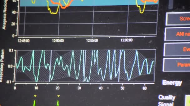 Modern Patient Monitor Elektronisk Hälsoövervakning Som Visar Medicinska Indikatorer Och — Stockvideo